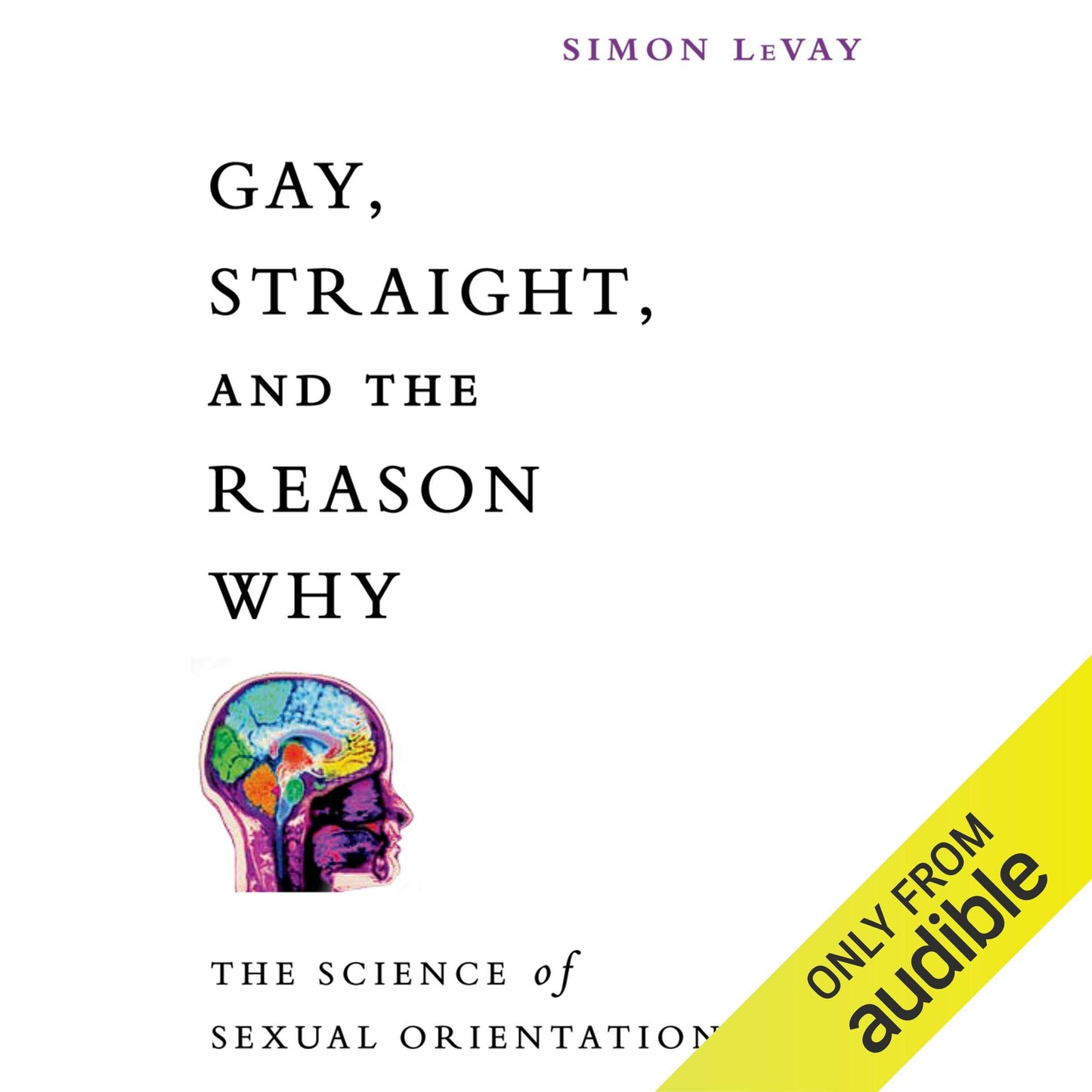 Gay, Straight, and the Reason Why: The Science of Sexual Orientation