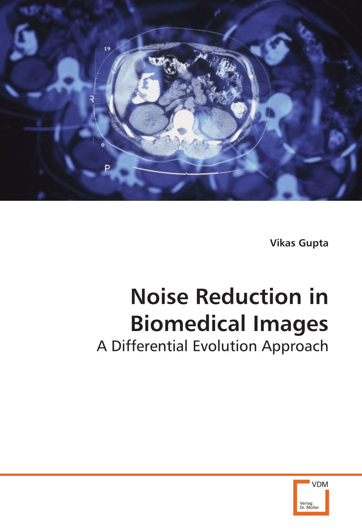 Noise Reduction in Biomedical Images: A Differential Evolution Approach