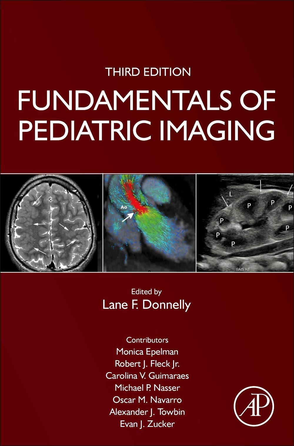 Fundamentals of Pediatric Imaging