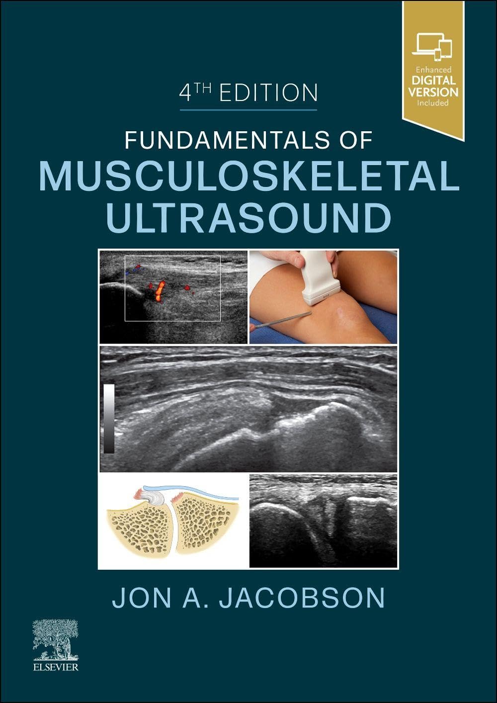 Fundamentals of Musculoskeletal Ultrasound (Fundamentals of Radiology)