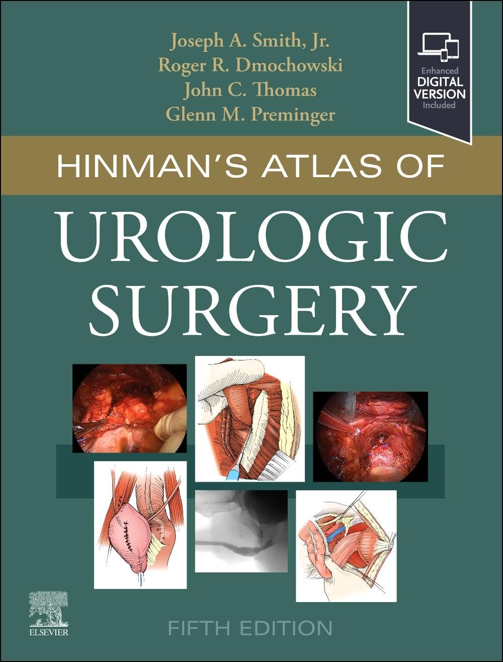 Hinman's Atlas of Urologic Surgery
