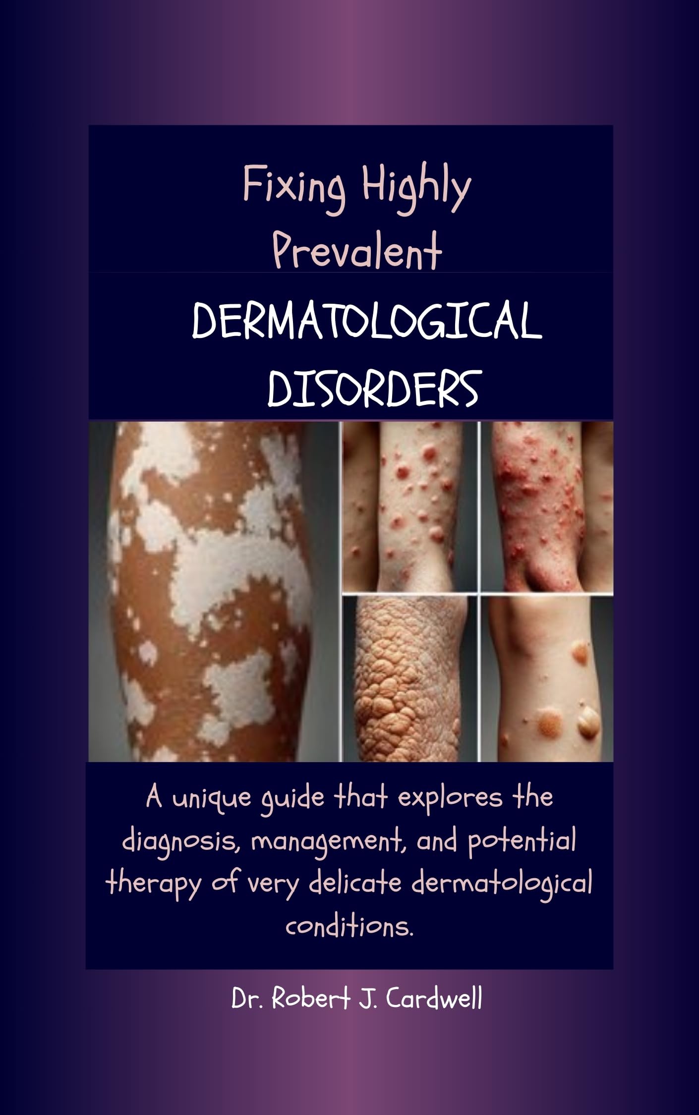 Fixing Highly Prevalent Dermatological Disorders: A unique guide that explores the diagnosis, management, and potential therapy of very delicate dermatological ... modern science health books Book 4)
